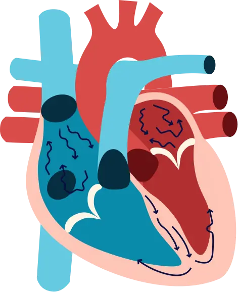Atrial fibrilation results in a turbulent blood flow inside the heart.