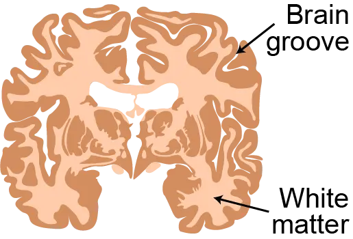 A cross-section of the human brain.