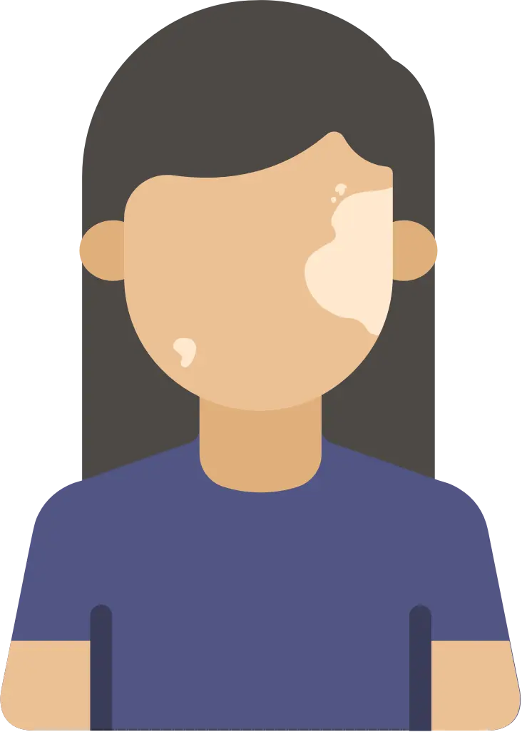 Vitiligo is characterized by patches of discolored skin.