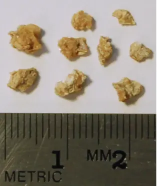 Kidney Stone Fragments